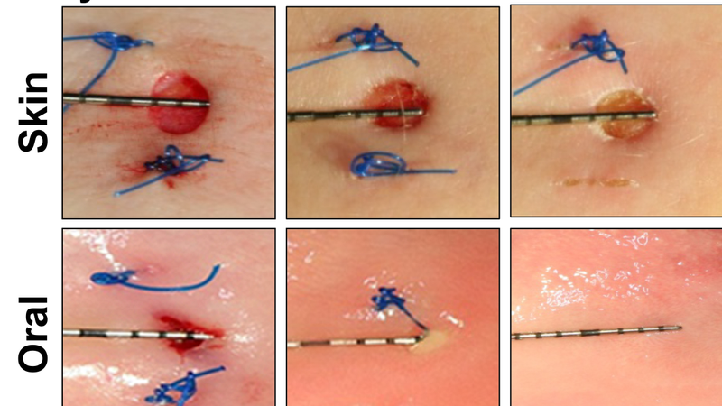 A comparison of one test subject’s skin and mouth wounds immediately after the injury, at three days, and at six days.